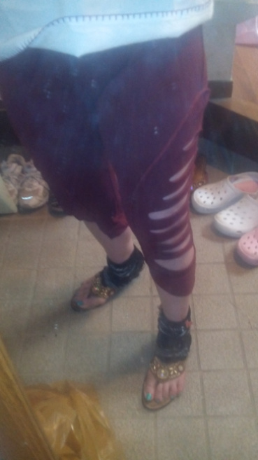 こももの評価写真